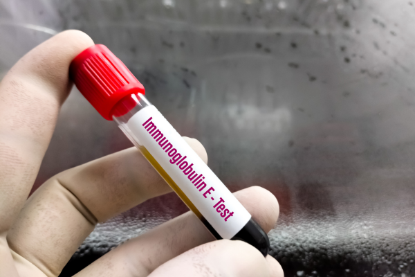 Immunoglobulin E wheat allergy blood test